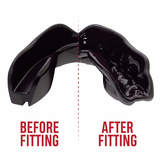 SafeJawz Black Intro Series Muay Thai Mouthguard SafeJawz Black Intro Series Muay Thai Mouthguard