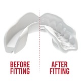 SafeJawz White Intro Series Muay Thai Mouthguard SafeJawz White Intro Series Muay Thai Mouthguard